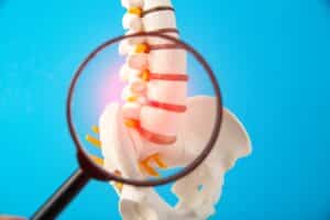 Model of human spine with magnifying glass on blue background, symbolizing lumbar spine disorders such as herniated discs, lumbago, and sciatica