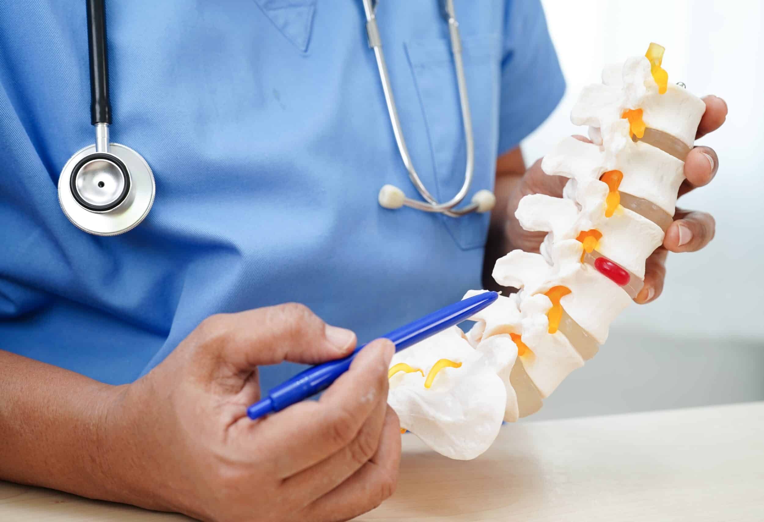 Doctor holding spinal nerve and bone model showing lumbar spine with herniated disc fragment for orthopedic treatment and education